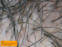 Load image into Gallery viewer, AS I AM Dry & Itchy Scalp Care Shampoo (12oz)